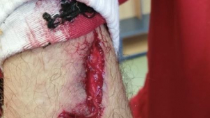 Sigmě budou chybět v neděli tři hráči